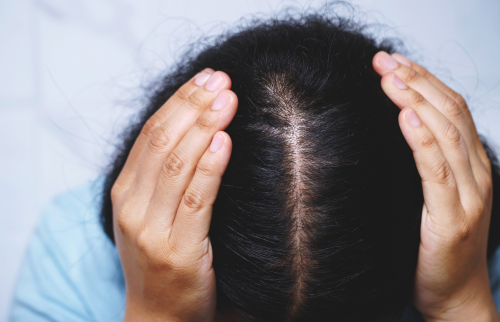 ما هو علاج اضطراب نتف الشعر؟