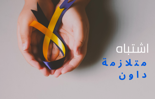 اشتباه متلازمة داون .. الأعراض و الاسباب