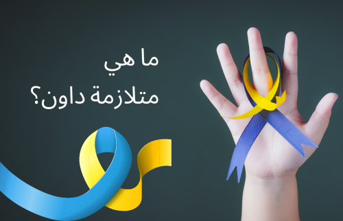 ما هي متلازمة داون؟