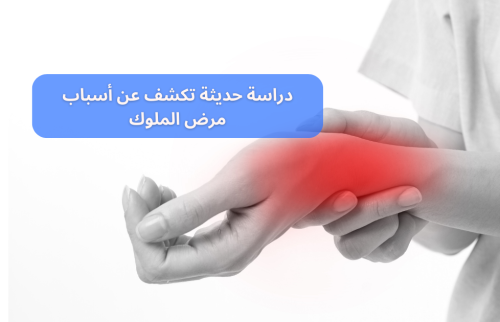 دراسة حديثة تكشف عن أسباب مرض الملوك