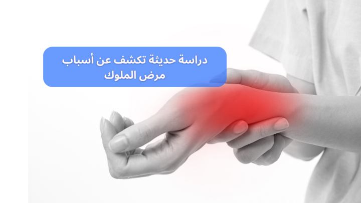 دراسة حديثة تكشف عن أسباب مرض الملوك