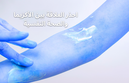 احذر العلاقة بين الأكزيما والصحة النفسية