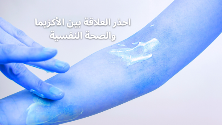 احذر العلاقة بين الأكزيما والصحة النفسية