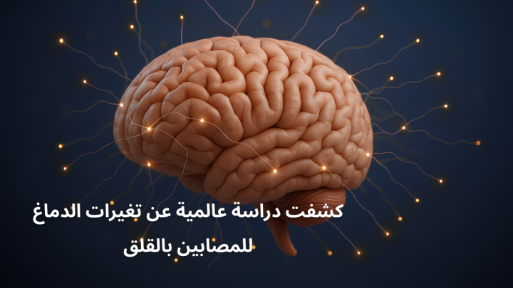كشفت دراسة عالمية عن تغييرات الدماغ الهيكلية للمصابين بالقلق